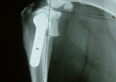 x-ray